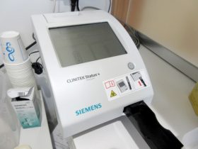 尿自動分析装置